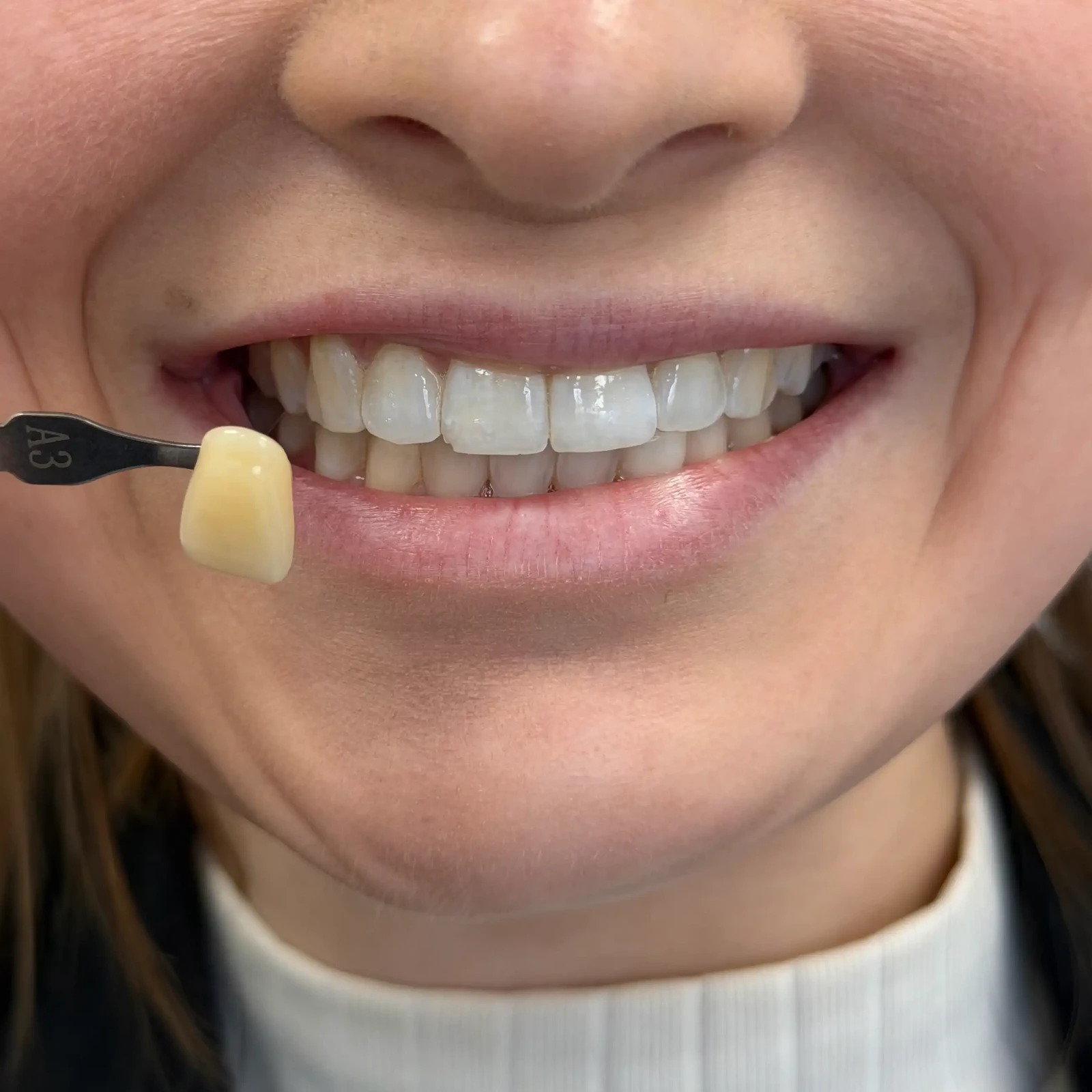 Tooth compare scaled